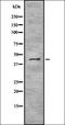 Translocation Associated Membrane Protein 2 antibody, orb337128, Biorbyt, Western Blot image 