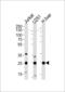 Glutathione S-Transferase Mu 1 antibody, LS-C166708, Lifespan Biosciences, Western Blot image 