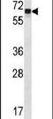 Angiopoietin 2 antibody, PA5-23612, Invitrogen Antibodies, Western Blot image 