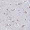 Myomaker, Myoblast Fusion Factor antibody, NBP2-34175, Novus Biologicals, Immunohistochemistry frozen image 