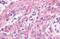G Protein-Coupled Receptor 17 antibody, NLS4228, Novus Biologicals, Immunohistochemistry frozen image 