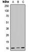 Centromere Protein A antibody, orb235090, Biorbyt, Western Blot image 