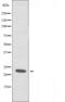 ATP Binding Cassette Subfamily C Member 3 antibody, orb226388, Biorbyt, Western Blot image 