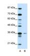 High Mobility Group 20A antibody, orb330047, Biorbyt, Western Blot image 