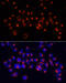 Alanyl-TRNA Synthetase antibody, A03935, Boster Biological Technology, Western Blot image 