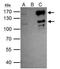 SET Domain Bifurcated Histone Lysine Methyltransferase 2 antibody, NBP2-20323, Novus Biologicals, Immunoprecipitation image 