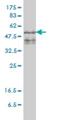 Zinc finger FYVE domain-containing protein 19 antibody, H00084936-M01, Novus Biologicals, Western Blot image 