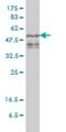 Zinc Finger FYVE-Type Containing 19 antibody, H00084936-M01, Novus Biologicals, Western Blot image 