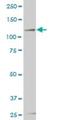 Homeodomain Interacting Protein Kinase 2 antibody, H00028996-M06, Novus Biologicals, Western Blot image 