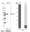 Acyl-CoA Binding Domain Containing 5 antibody, HPA011861, Atlas Antibodies, Western Blot image 