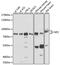 Neurofibromin 2 antibody, A00279, Boster Biological Technology, Western Blot image 