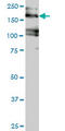 Eukaryotic Translation Initiation Factor 4 Gamma 3 antibody, LS-C133562, Lifespan Biosciences, Western Blot image 