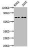 Activating Transcription Factor 2 antibody, CSB-RA002270A0HU, Cusabio, Western Blot image 