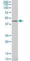 LIM Homeobox 4 antibody, H00089884-M05, Novus Biologicals, Western Blot image 