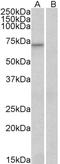 Forkhead Box O3 antibody, LS-B3932, Lifespan Biosciences, Western Blot image 
