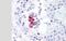 TANK Binding Kinase 1 antibody, NB100-56705, Novus Biologicals, Immunohistochemistry paraffin image 