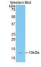 Transcription factor 20 antibody, LS-C304092, Lifespan Biosciences, Western Blot image 