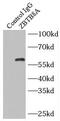 Zinc Finger And BTB Domain Containing 8A antibody, FNab09599, FineTest, Immunoprecipitation image 