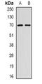 Essential Meiotic Structure-Specific Endonuclease 1 antibody, orb341487, Biorbyt, Western Blot image 