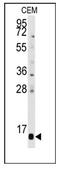 Prefoldin Subunit 6 antibody, AP12491PU-N, Origene, Western Blot image 