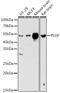 Placental Growth Factor antibody, GTX54606, GeneTex, Western Blot image 