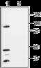 Potassium Two Pore Domain Channel Subfamily K Member 1 antibody, GTX16685, GeneTex, Western Blot image 