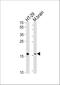 Transmembrane Protein 160 antibody, A16694, Boster Biological Technology, Western Blot image 