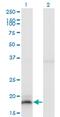 Interferon alpha-13 antibody, MA5-24415, Invitrogen Antibodies, Western Blot image 