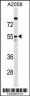 Rho GTPase Activating Protein 1 antibody, 60-156, ProSci, Western Blot image 