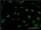 Serine/Threonine Kinase 32B antibody, H00055351-M01, Novus Biologicals, Immunocytochemistry image 