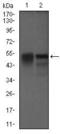 Dynactin Subunit 4 antibody, MA5-17065, Invitrogen Antibodies, Western Blot image 