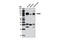 Golgi Associated, Gamma Adaptin Ear Containing, ARF Binding Protein 3 antibody, 8027S, Cell Signaling Technology, Western Blot image 