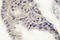 Recoverin antibody, LS-C176751, Lifespan Biosciences, Immunohistochemistry frozen image 