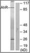Aryl Hydrocarbon Receptor antibody, orb93065, Biorbyt, Western Blot image 