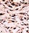 SMAD Family Member 4 antibody, AP12711PU-N, Origene, Immunohistochemistry frozen image 