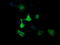 Mitogen-Activated Protein Kinase Kinase 3 antibody, LS-C174436, Lifespan Biosciences, Immunofluorescence image 