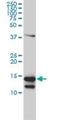 CD247 Molecule antibody, H00000919-M01, Novus Biologicals, Western Blot image 