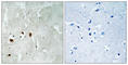 Q92993-3 antibody, abx012710, Abbexa, Western Blot image 