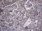 Scm Polycomb Group Protein Homolog 1 antibody, LS-C791635, Lifespan Biosciences, Immunohistochemistry paraffin image 