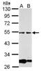 Glial Cells Missing Transcription Factor 1 antibody, GTX112119, GeneTex, Western Blot image 