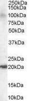 ADP Ribosylation Factor Like GTPase 6 Interacting Protein 5 antibody, PA1-31084, Invitrogen Antibodies, Western Blot image 