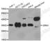 Orosomucoid 1 antibody, A1799, ABclonal Technology, Western Blot image 
