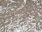 Angiopoietin Like 2 antibody, 12316-1-AP, Proteintech Group, Immunohistochemistry frozen image 