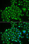 Recoverin antibody, 22-194, ProSci, Immunofluorescence image 