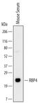 Retinol Binding Protein 4 antibody, MAB34761, R&D Systems, Western Blot image 