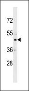 Carbohydrate Sulfotransferase 10 antibody, LS-C159349, Lifespan Biosciences, Western Blot image 