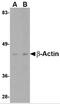 Beta-Actin antibody, 5005, ProSci Inc, Western Blot image 