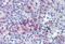 Spi-1 Proto-Oncogene antibody, MBS246934, MyBioSource, Immunohistochemistry paraffin image 