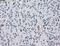 Isocitrate Dehydrogenase (NADP(+)) 1, Cytosolic antibody, NBP1-47804, Novus Biologicals, Immunohistochemistry paraffin image 