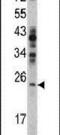 RAN, Member RAS Oncogene Family antibody, PA5-13652, Invitrogen Antibodies, Western Blot image 